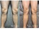 シルビー(CILBE)の写真/清潔感を磨くメンズのご来店も多数！VIOケアで自信あふれる理想の自分を目指しませんか？◎