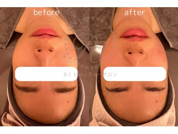 R-1ビューティーサロン 表参道/Before&After