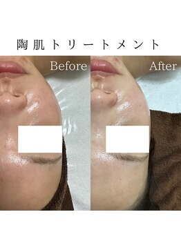 ビューティービューティー(BEAUTY BEAUTY)/