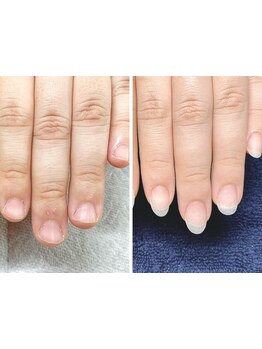 爪の悩みを解消できる（ケア含む）