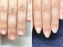 エーネイル(a nail)