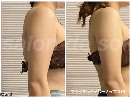 サロン ド ソワ(salon de soi)の写真