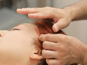 セットアップ鍼灸院(setup鍼灸院)/