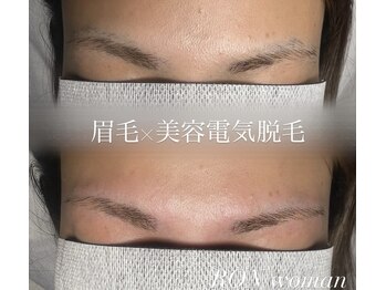 サロンロンウーマン(SALON RON woman)/眉毛脱毛