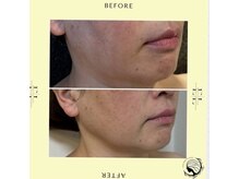 スプレール 水戸店/ExoLif（エクソリフト）