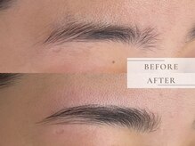 レヴィア(Revia)/ハリウッドブロウリフト