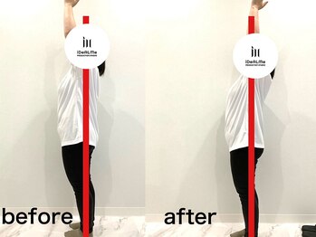 ディアルミィ 川崎店(iDeALMe)/腕が上がらない悩みを改善!