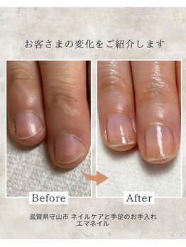 エマネイル(emma nail)/自爪育成やってます！