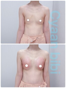 シアンビビ(Cyaan bibi)/