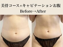 アトレセカンドボディ(Attrait second body)/Before→After【2回目】