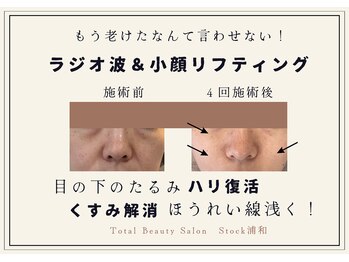 ストック 浦和(Stock)