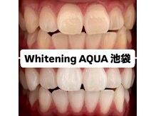 アクア 池袋店(AQUA)/ホワイトニング/池袋/東京/美白