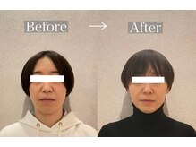 モリカ(morika)の雰囲気（頭、首肩周りをしっかりほぐしてシャープなフェイスラインへ。）