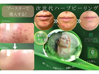 アメリオレ 国分寺店(AMELIORER)の写真/「こすらない」次世代ハーブで肌改善★発酵ビタミン原液×贅沢ブースターで、かつてない透明ツヤ肌へ