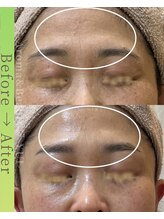 アロマアンドビューティー 結/眉間・額、若々しい印象へ