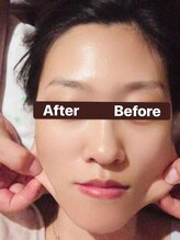 モデルや女優も通う高い技術力が自慢【店長キョウ限定:Special強力小顔コルギ30分¥4500】