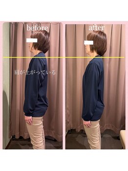 アイリー(Irie)/骨格矯正