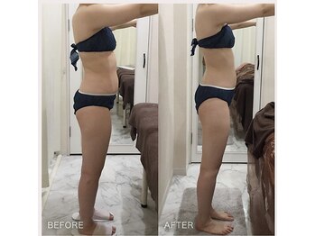 えすてさろん ケイアンドエフ(k&f)/【痩身】２ヶ月半で美ボディ20代