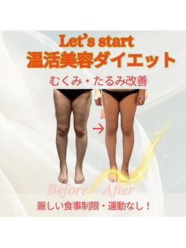 ヨサパーク ジュエル ハビビ 水木店(YOSA PARK JEWEL HABIBI)/お客様の施術後ボディ変化お写真