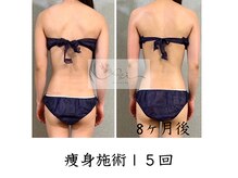 アイ エステサロン(Ai)/【ブライダル痩身】背中・二の腕