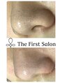 ザ ファーストサロン(The First Salon) 毛穴洗浄