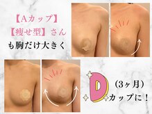 ミネアヴァリー(Mine A Valley)の雰囲気（他バストサロンと違い、加工写真/ブラ・タオルのバスト寄せなし）