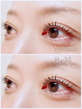 リエム(ReM)/リフトカール