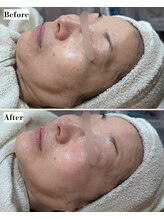 ソワナ(soina)/【神楽坂駅/フェイシャル/毛穴】