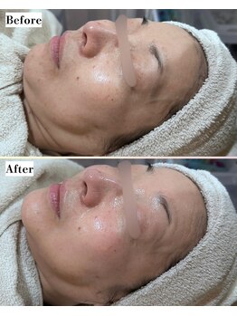 ソワナ(soina)/【神楽坂駅/フェイシャル/毛穴】