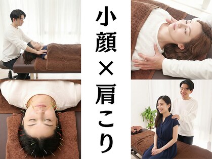 ダズル(DAZZLE)の写真