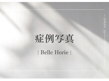 ベル 堀江(Belle)/ハーブピーリング｜写真