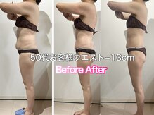 ヴィクシア(VIXIA)