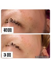 ビューティーサロン キャンディ 海老名(Candy)/