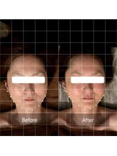 セメ(S’aimer)/脳洗浄で小顔効果バツグン！