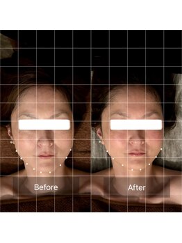 セメ(S’aimer)/脳洗浄で小顔効果バツグン!