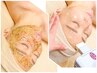 No1☆ハーブピーリング×美肌顔脱毛【本気の肌質改善・結果を求める方へ☆】