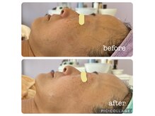 ソット(sotto)の雰囲気(業界No.1★リアボーテ正規取扱店/10回のエステより1回のハーブ)