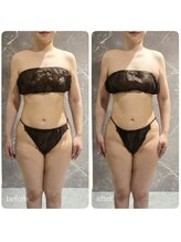 インディバ 六本木/【上半身集中】before→after