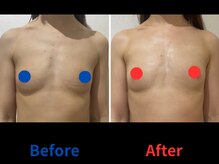 ポインセチア(Poinsettia)/ダイナミックバスト4DX/並び比較