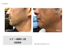 ディーエムピーコネクト(dmp connect)