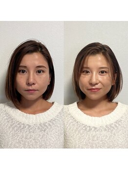 パーソナルサンフラワー(PersonalSunflower)/お客様ヘアメイク Before/After