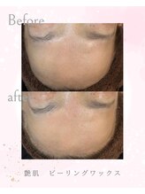 ソレラ(sorelle)/ピーリングワックス