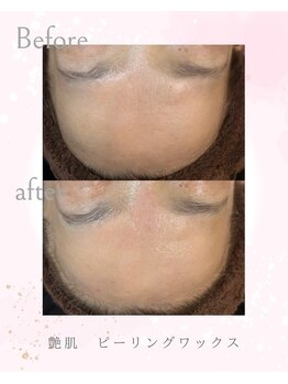 ソレラ(sorelle)/ピーリングワックス