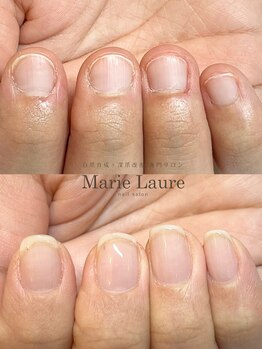 マリーロール 梅田店(Marie Laure)/自爪育成/深爪矯正/ネイルケア