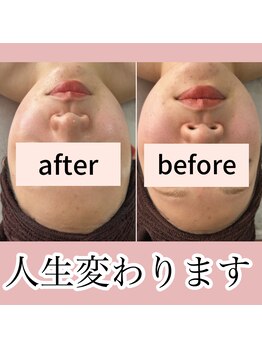 ゴールデンケア(goldencare)/フェイスラインあきらめないで