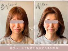 ほぐし屋 かすがい/小顔リフト矯正＋美姿勢整体
