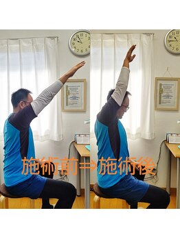 シャロームカイロプラクティックおおば/肩こりで腕があがらない【整体】