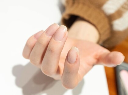 ネルケア(NERUKEA)の写真
