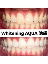 アクア 池袋店(AQUA)/ホワイトニング/池袋/東京/美白