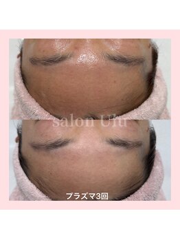 ウル(Ulu)/赤み毛穴透明感